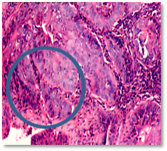 Esp�cimen de laringectom�a total (H-E)