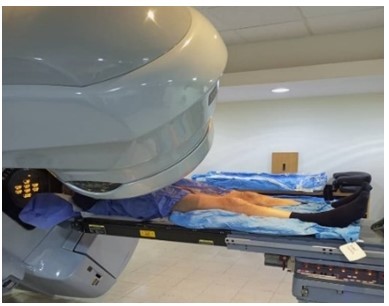 Paciente con CP en posición de tratamiento supino con colchón inmovilizador al vacío.