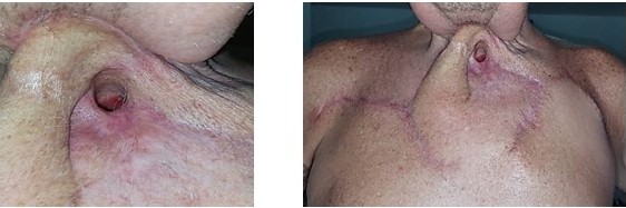 Resultado final de las doc intervenciones quirrgicas