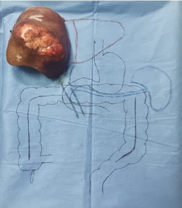 Representaci�n esquem�tica de pieza anat�mica