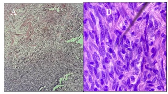 Patrn hipo e hipercelular (a). Mitosis (b).