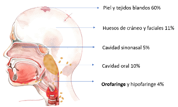 Distribucin de sarcomas en regin de cabeza y cuello