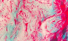 Secciones de parafina de 8 m de grosor teidas con tricrmico de Gomori 400x. destaca la presencia de clulas y fibras musculares teidas de rojo y color verde colgeno en zonas hialinizadas.