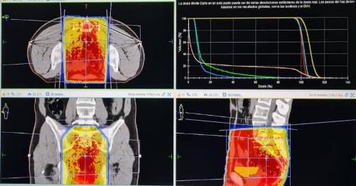 Planificaci�n MOSAIQ