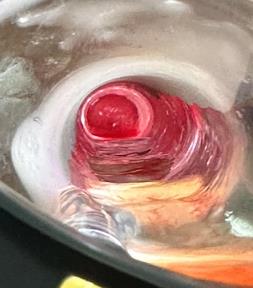 Evaluaci�n de respuesta y seguimiento