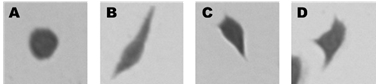 Diferentes tipos de morfolog&iacute;as que pueden aparecer en los ensayos in vitro
de HUVEC. (A) circulares, (B) elongadas, (C) y (D) otras deformaciones que
incluyen c&eacute;lulas con brotes y prolongamientos direccionales.