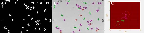  (A) Umbralizaci&oacute;n
obtenida. (B) Bordes finales obtenidos y clasificaci&oacute;n de las c&eacute;lulas seg&uacute;n sus
morfolog&iacute;as: en rojo c&eacute;lulas circulares, en verde c&eacute;lulas deformadas alargadas
y en morado c&eacute;lulas deformadas poco alargadas. (C) Gr&aacute;fico de distribuci&oacute;n de
las c&eacute;lulas seg&uacute;n la relaci&oacute;n ESF/CSF.