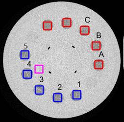 Regiones de inter&eacute;s y fondo seleccionadas en el estudio, azul las fibras de nailon, rojo las motas y magenta el fondo. 
