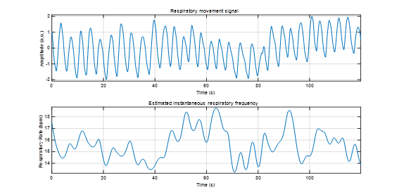 Respiratory movement signal (sampled at 25 samples/s) obtained with a temperature sensor (apparently, a thermistor) around the mouth and the nose of a subject (plot on top) and the instantaneous-respiratory frequency (respiration rate) estimated from it (plot on the bottom) (V&aacute;zquez-Segura et al., 2018).
