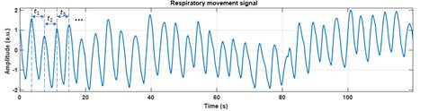 Intervals between consecutive peaks in the respiratory movement signal.