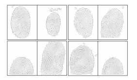 Pairs of genuine skeleton impressions form FVC 2002 DB1A that were correctly matched when the topological features were added in the local matching. In this impression can be observed a relative low minutiae density in the overlap region.