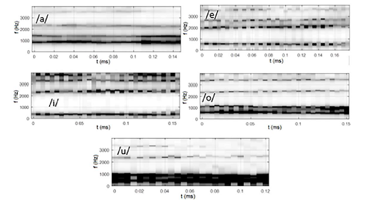 Cocleogramas de las vocales desde la /a/ hasta la /u/ para un locutor masculino.
