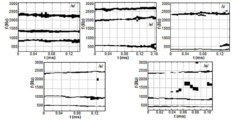 Proceso de inhibición lateral para las vocales de un locutor masculino en el idioma español, XLI .
