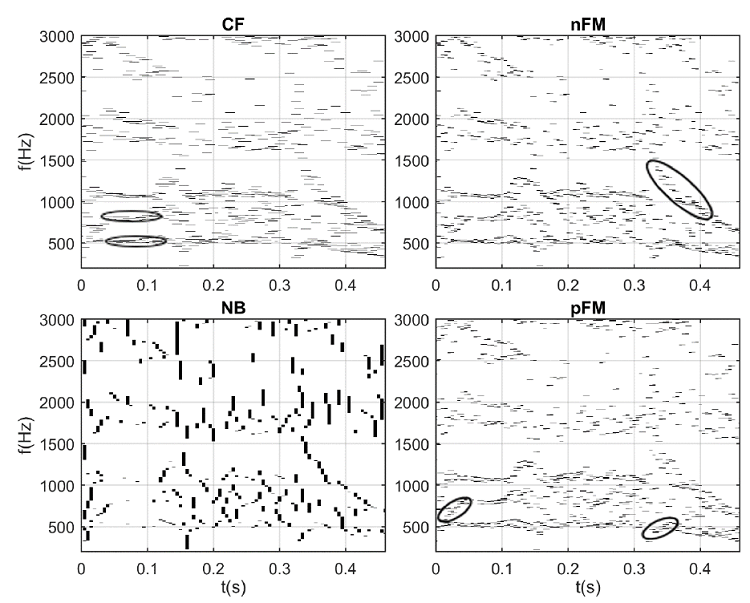 Respuesta de las neuronas básicas del habla para la palabra /foto/ de un locutor femenino.