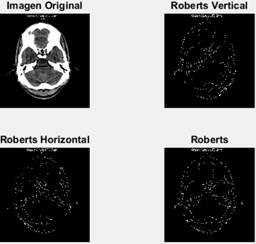 La imagen original (superior izquierda), detectando bordes verticales (superior derecha), detectando bordes horizontales (inferior izquierda) y bordes totales (inferior derecha).
