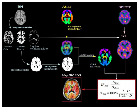 Esquema de la metodología de cuantificación del FSCr. CVP se refiere a la corrección del volumen parcial. 
