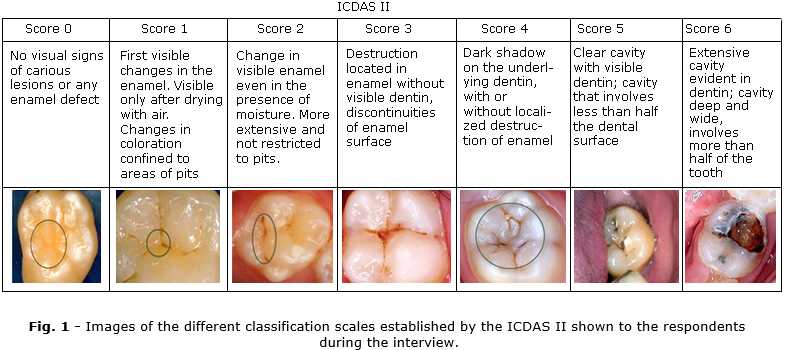 - Images of the different classification scales established by the ICDAS II shown to the respondents during the interview.