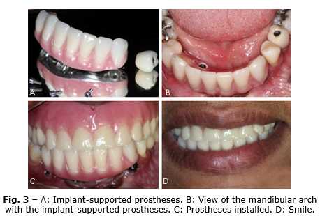 Slabire Picioare Femei Bune Care - consilier-dezvoltare-personala.ro - Cancer bucal por brackets