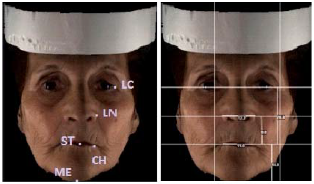 Puntos de referencia utilizados y mediciones efectuadas.