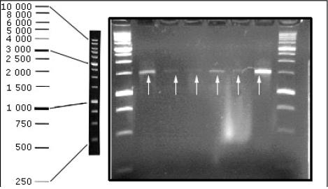 Control positivo de 16s rRNA con un peso molecular de 1 500 bp, con 1kb marcador molecular en cada lado.