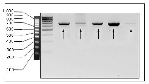 Muestra de Prophyromonas endodontalis amplificada con un peso molecular de 674 pb (flechas), junto con un ladder de 100 pb a la derecha. Gel tratado por un programa de visualizaci&oacute;n como muestra negativa.
