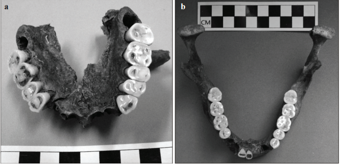 Detalle con piezas in
situ y ausentes en el maxilar (a) y la mand&iacute;bula (b)