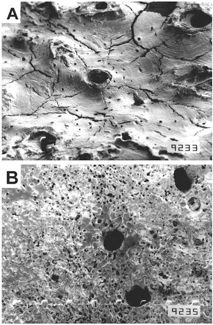 Fig. 3. Ejemplos de im&aacute;genes de electrones secundarios (MEB-ES) obtenidas a partir de huesos arqueol&oacute;gicos (microscopio JEOL JSM T100, Servicio de Microscop&iacute;a Electr&oacute;nica de Barrido, FCNyM, UNLP). En (A) (150X) se observa una buena preservaci&oacute;n histol&oacute;gica, distingui&eacute;ndose claramente los canales de Havers (con probables dep&oacute;sitos internos de calcita), las lamelas y las lagunas; las microfisuras radiales y a lo largo de las l&iacute;neas de cemento son, probablemente, un artefacto de la t&eacute;cnica (deshidrataci&oacute;n y alto vac&iacute;o). En (B) (150X) se observa una muy mala preservaci&oacute;n histol&oacute;gica (asimilable al valor 0 del IH); n&oacute;tese la distribuci&oacute;n de poros de diferente tama&ntilde;o alrededor de los canales de Havers y la p&eacute;rdida generalizada de rasgos microestructurales. Modificadas a partir de Barrientes (1997).