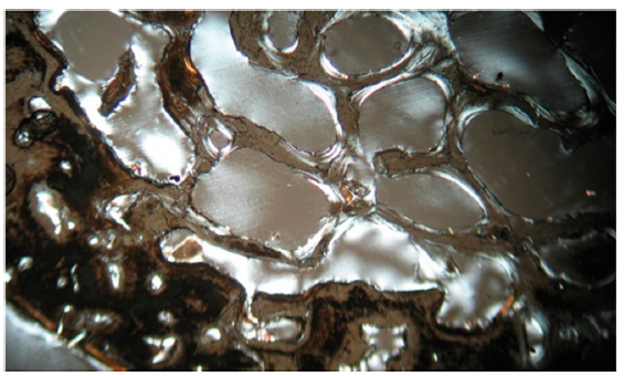 Vista microsc&oacute;pica del Caso 1: Trabecularizaci&oacute;n en secci&oacute;n &oacute;sea transversal de Chiapa de Corzo, Tumba 1. Luz polarizada sin color, lente10x10.