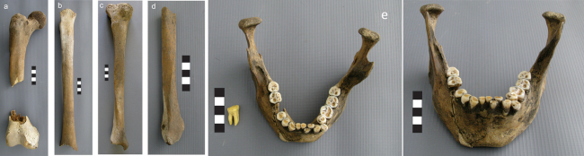 Individuo 1. a) F&eacute;mur derecho. b) F&eacute;mur izquierdo. c) Tibia derecha. d) Peron&eacute; derecho. e) Mand&iacute;bula y r&eacute;plica dental del 1&deg;MD extraido para ADN.