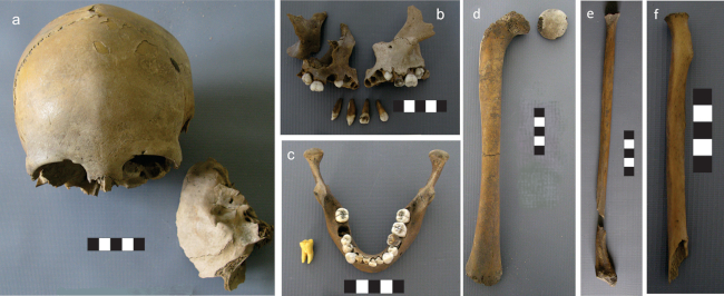 Individuo 2. a) Cr&aacute;neo. b) Maxilar. c) Mand&iacute;bula, a su izquierda la r&eacute;plica dental del 1&ordm;MD. d) F&eacute;mur derecho. e) Peron&eacute; derecho. f) Radio derecho.