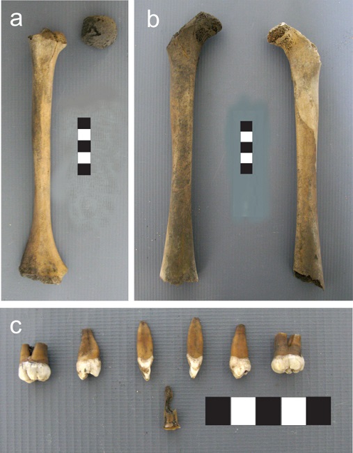 Individuo 3. a) H&uacute;mero derecho. b) F&eacute;mures derecho e izquierdo. c) Piezas dentales.