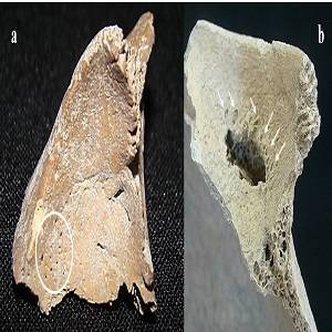 (a) Criba orbitaria activa, orbita izquierda (infante). (b) Criba orbitaria inactiva, orbita izquierda (adulto joven femenino).