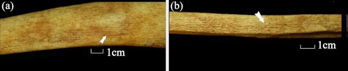 Reacciones peri&oacute;sticas proliferativas en la tibia derecha (a) y el peron&eacute; derecho (b) del individuo MFM 2670. Las flechas se&ntilde;alan la ubicaci&oacute;n de las lesiones.