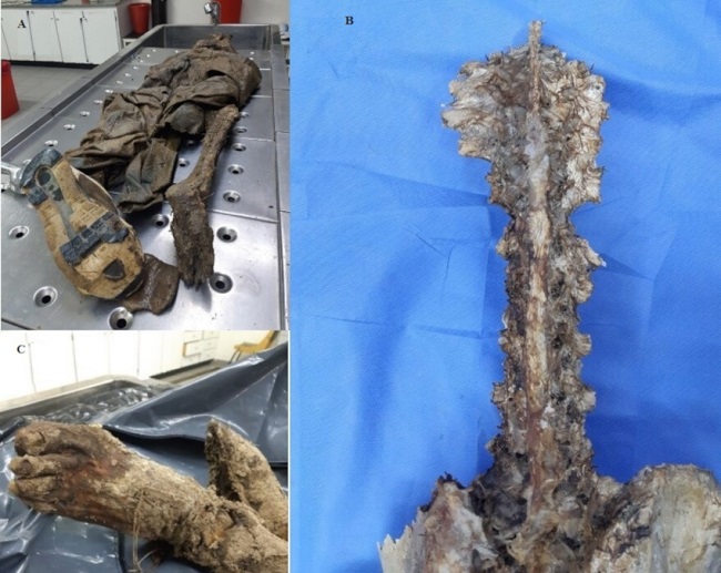 A) Detalle del estado de los restos al llegar al laboratorio de la Morgue Judicial. B) Destrucci&oacute;n parcial de cuerpos vertebrales. C) Pie momificado.
