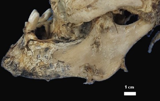 Vista lateral de la mand&iacute;bula mostrando reabsorci&oacute;n &oacute;sea por retracci&oacute;n alveolar.