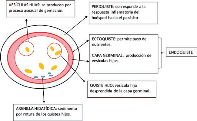 Esquema de la estructura del quiste hidatídico.