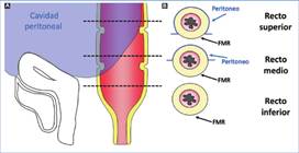 Relaciones anatómicas entre el recto y el peritoneo. Figura esquemática de las relaciones anatómicas entre el recto y el peritoneo, donde se observa que una porción del recto superior y medio es intraperitoneal (zona azul), mientras que el resto es extraperitoneal. Las líneas de trazo marcan los diferentes niveles de corte de las imágenes axiales esquematizadas, en las cuales se identifica que el peritoneo cubre casi la totalidad del mesorrecto a nivel del recto superior exceptuando su porción posterior, cubierta por la FMR. A nivel del recto medio la porción peritonizada se limita a la cara anterior y parte de los laterales, mientras que el mesorrecto a nivel del recto inferior está recubierto por todas sus caras por la FMR.