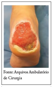 Ferida do participante 6: no 1 dia do seguimento de 10 semanas 