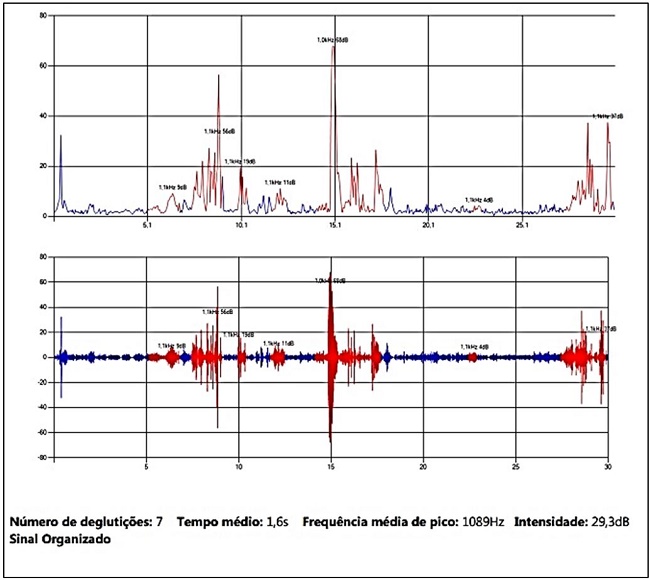 Gráfico gerado pelo programa Deglutisom®