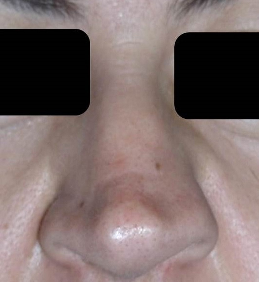 Pre-operatory patient photo.