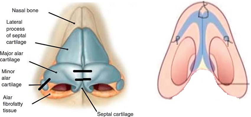 Details of suturing.