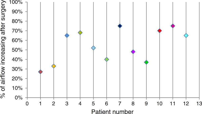 Diagram of patient increasing nasal air flow after surgery.