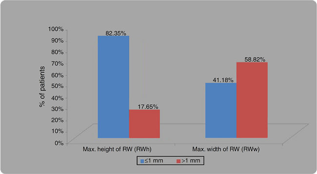 Bar diagram showing frequency of distribution for maximum height
                                of RWM (RWh) and maximum width of RW (RWw), of &le;1 and >1
                                mm.