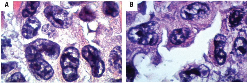 Histopathological analyzes of tumor cells