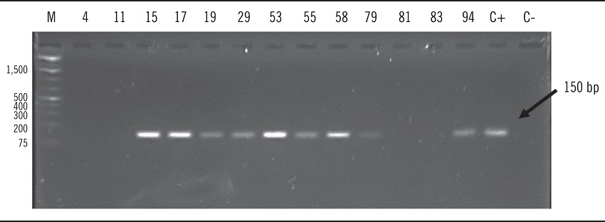Photograph of 1.6% agarose gel stained with ethidium bromide as a
							result of gene amplification of the 16S rRNA (HpX/HpX1) with the
							expected size of 150 bp