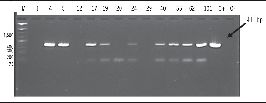 Photograph of 1.6% agarose gel stained with ethidium bromide as a
							result of amplification of the UreA gene (H5/H6) with the expected size
							of 411 bp