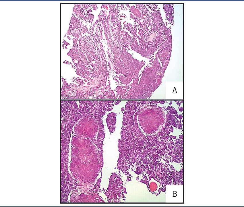 Histopathological features