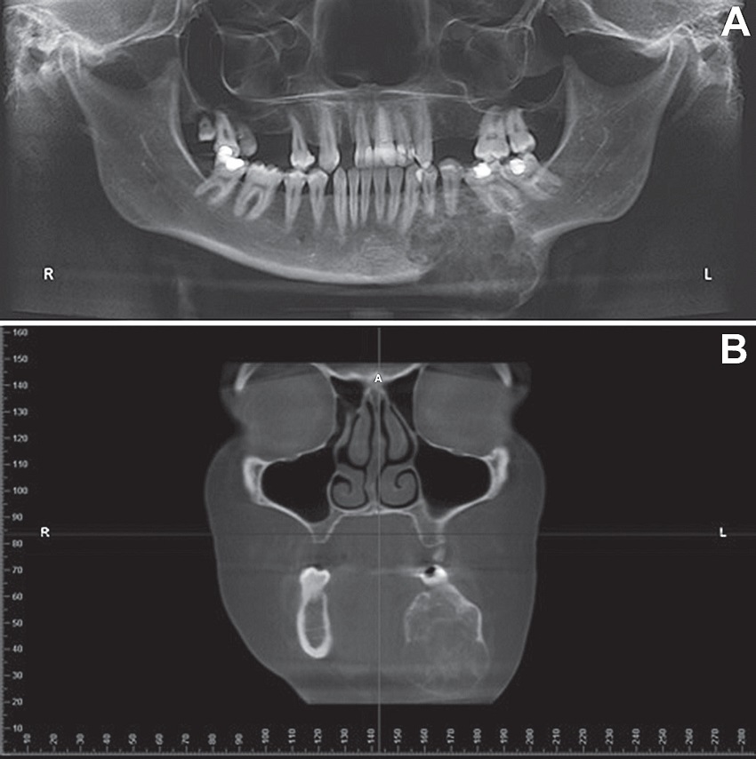 Preoperative imaging
