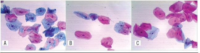 Staining classified as optimal in three fixation times A) seven days
							fixation; B) 30-minutes fixation; C) 15-minutes fixation.