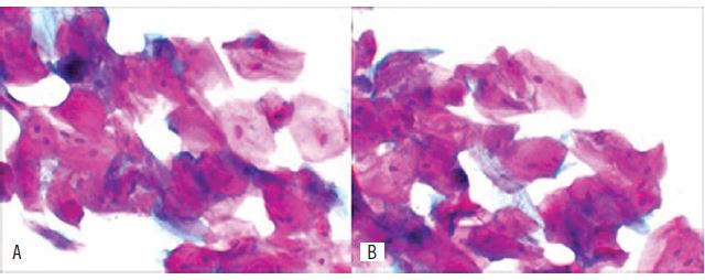 Staining classified as regular in two fixation times A) 30-minutes
							fixation; B) 15-minutes fixation.